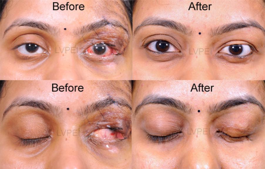 Injuries and Fractures